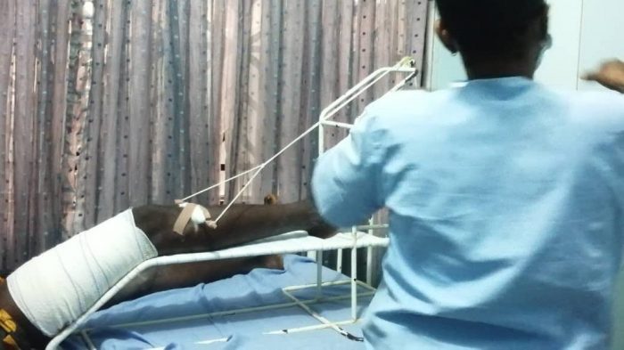 Aliyu undergoing treatment