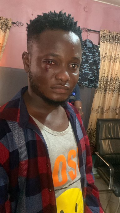 Ajibade and his brother's battered faces