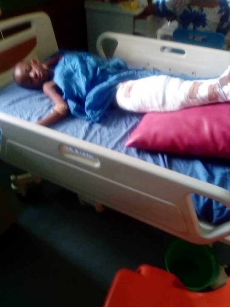Busayo in hospital just after the accident 