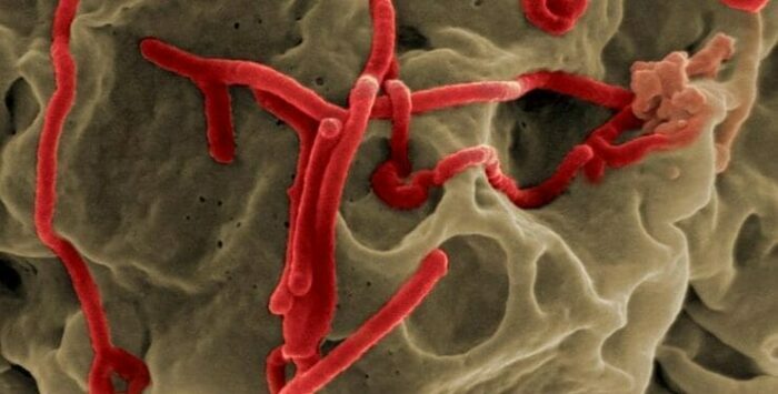Sudan Ebola Virus