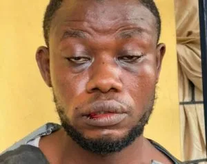 Eric Nana Gyetuah After He Was Beaten by the Police in Ghana