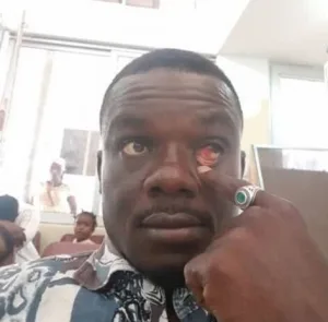 Malik Sullemana After He Was Attacked by the Police in Ghana