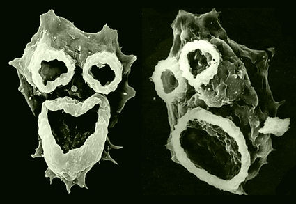 Microscope zooms in on Naegleria Fowleri the Amoeba