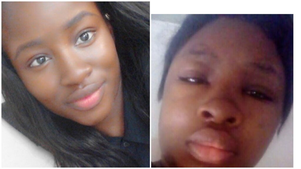 A collage of Owolabi's pictures taken before and after she was diagnosed of Lupus