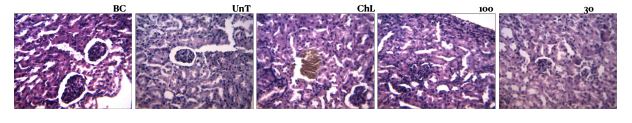 Histological representation of kidney of mice in different treatment groups