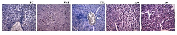 Histological representation of liver of mice in different treatment groups