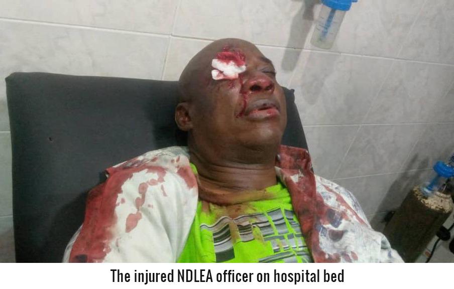 Injured NDLEA official on hospital bed