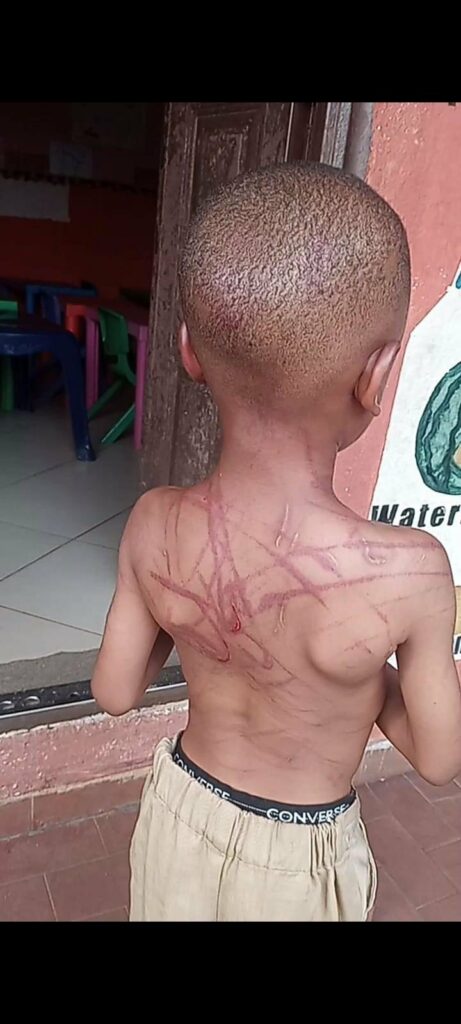 Injury inflicted on 5-year-old boy