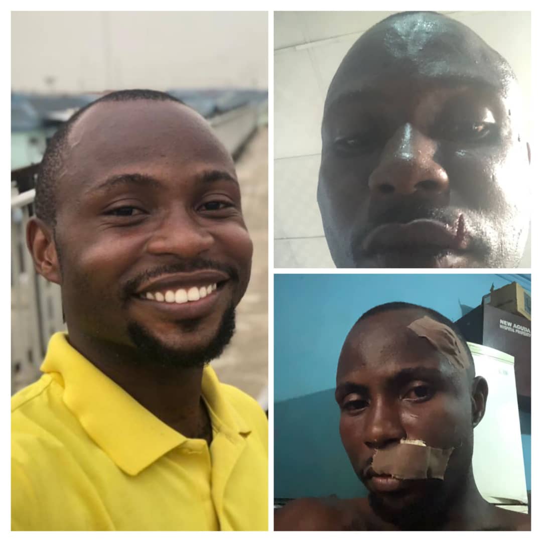 'Mad Couple Labelled Innocent Lagos Driver a Thief After Bashing His Car. He Was Almost Beaten to Death'