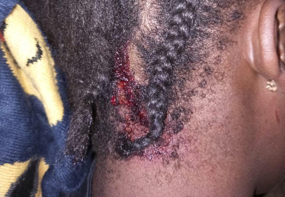 Abuja Guardian Shows No Remorse for Inflicting Injuries on 16-Year-Old Girl