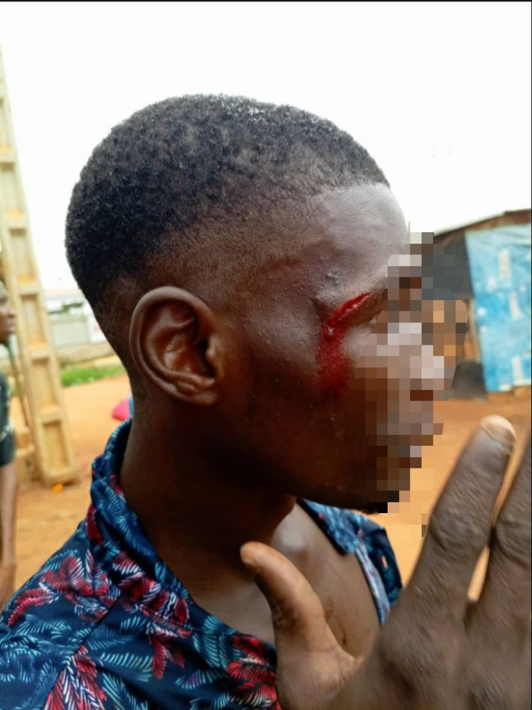 A resident who was beaten and injured by thugs hired by the land grabbers