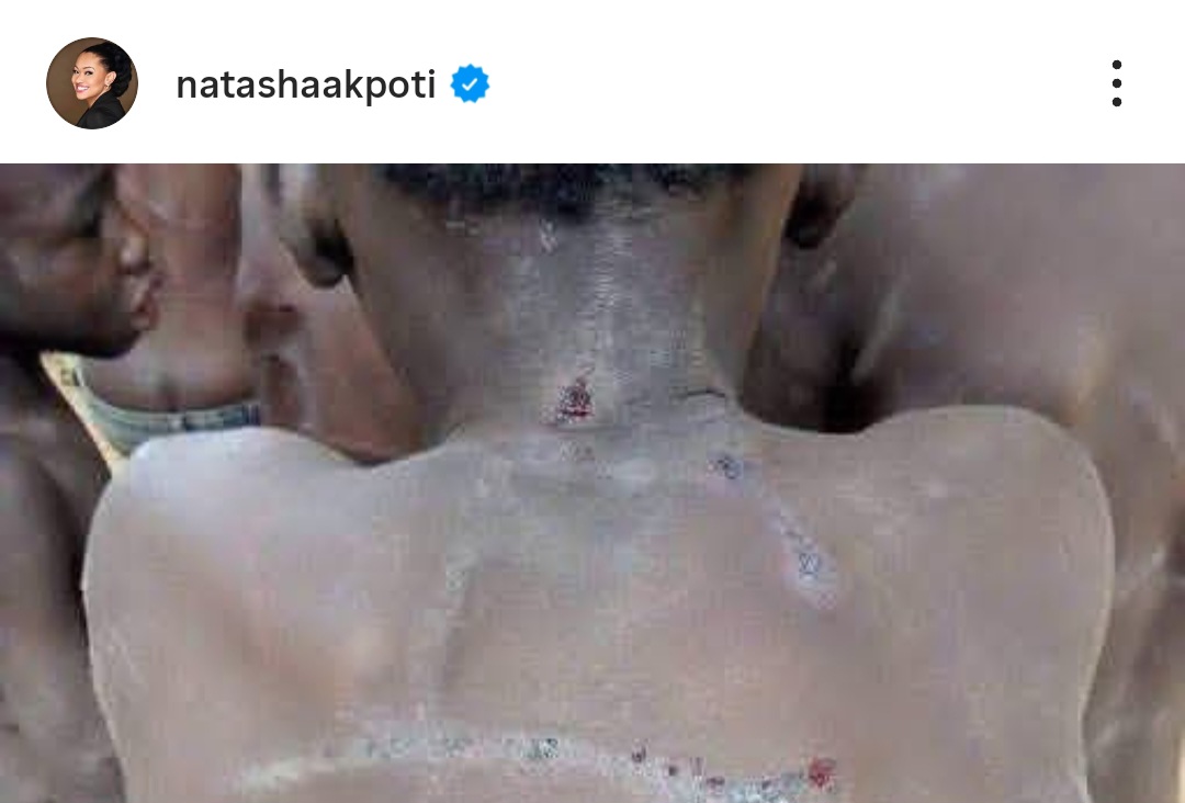 FACT-CHECK: Natasha Akpoti Shared Images of Abducted Oyo Children 'Beaten'. Those Pictures Are 6 Years Old